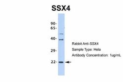 SSX4 Antibody, Novus Biologicals 100 &mu;L | Buy Online | Novus Biologicals | Fisher Scientific